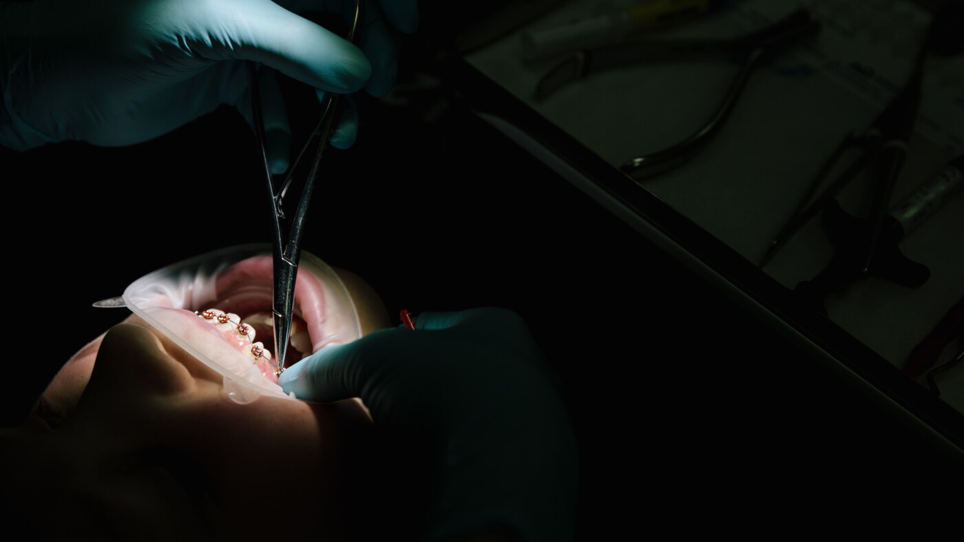 Orthodontie in Meerkerk, Beugel Meerkerk, Orthodontist Meerkerk